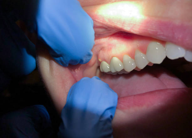 Best Broken Tooth Emergency  in Gardner, IL